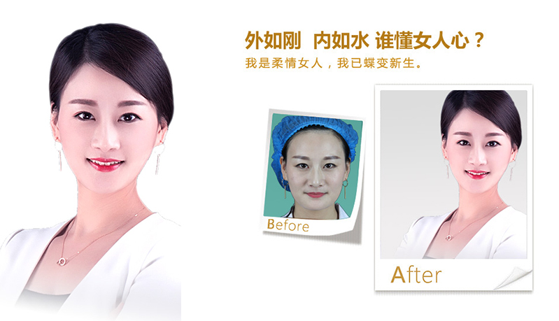 嘉义V脸、线雕隆鼻